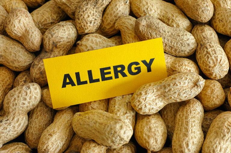 5 most common food allergies