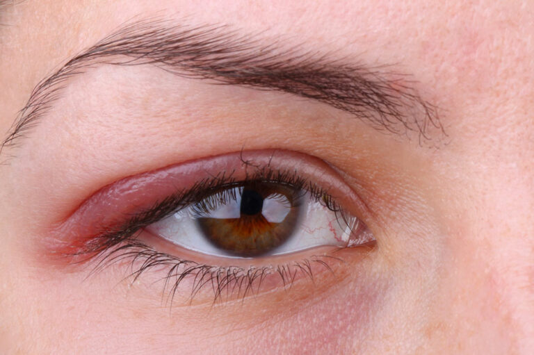 Top 3 conditions that affect eye health